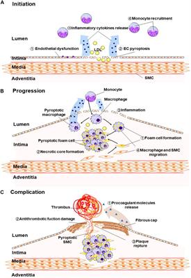 Pyroptosis in the Initiation and Progression of Atherosclerosis